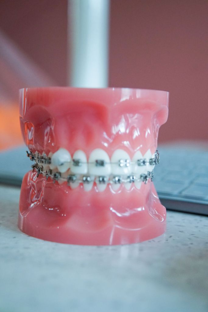 A close-up of a pink anatomical dental model of human teeth showing a full set of silver metal braces.