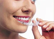 A close-up of a smiling woman's face as she uses her hands to place a clear, plastic orthodontic aligner over her top teeth.