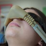 Close-up of a patient lying down wearing a tan nitrous oxide (laughing gas) sedation mask over their nose during a dental procedure.