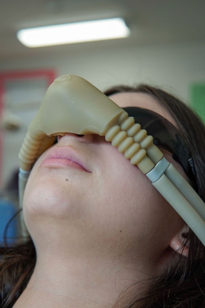 Close-up of a patient lying down wearing a tan nitrous oxide (laughing gas) sedation mask over their nose during a dental procedure.