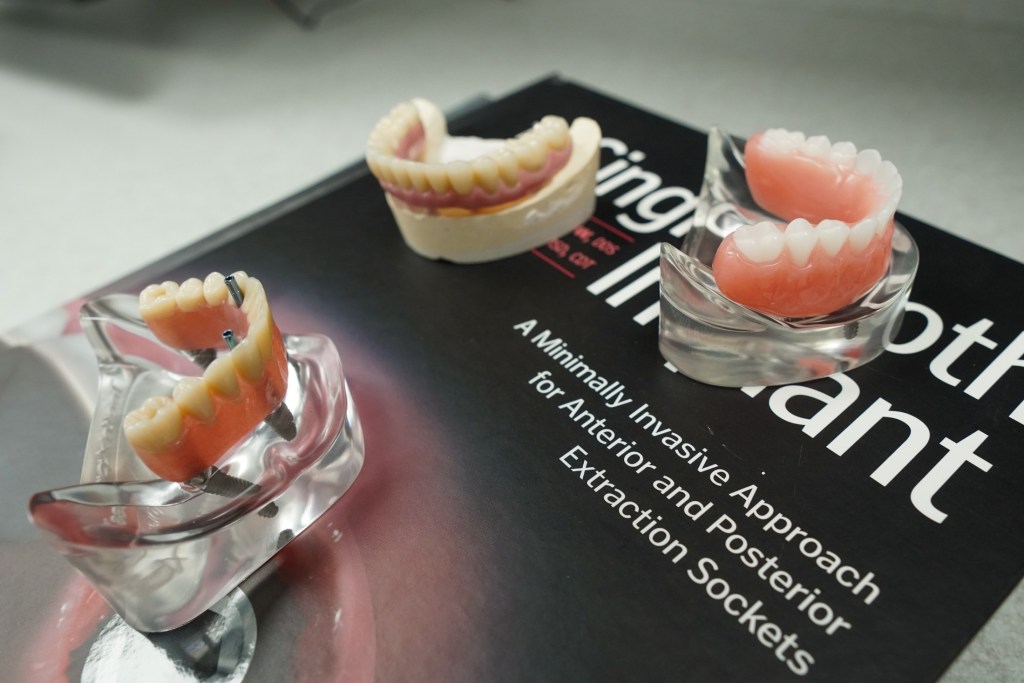 Three different anatomical models of dental implants and dentures displayed on top of a black informational brochure.