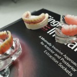 Three different anatomical models of dental implants and dentures displayed on top of a black informational brochure.
