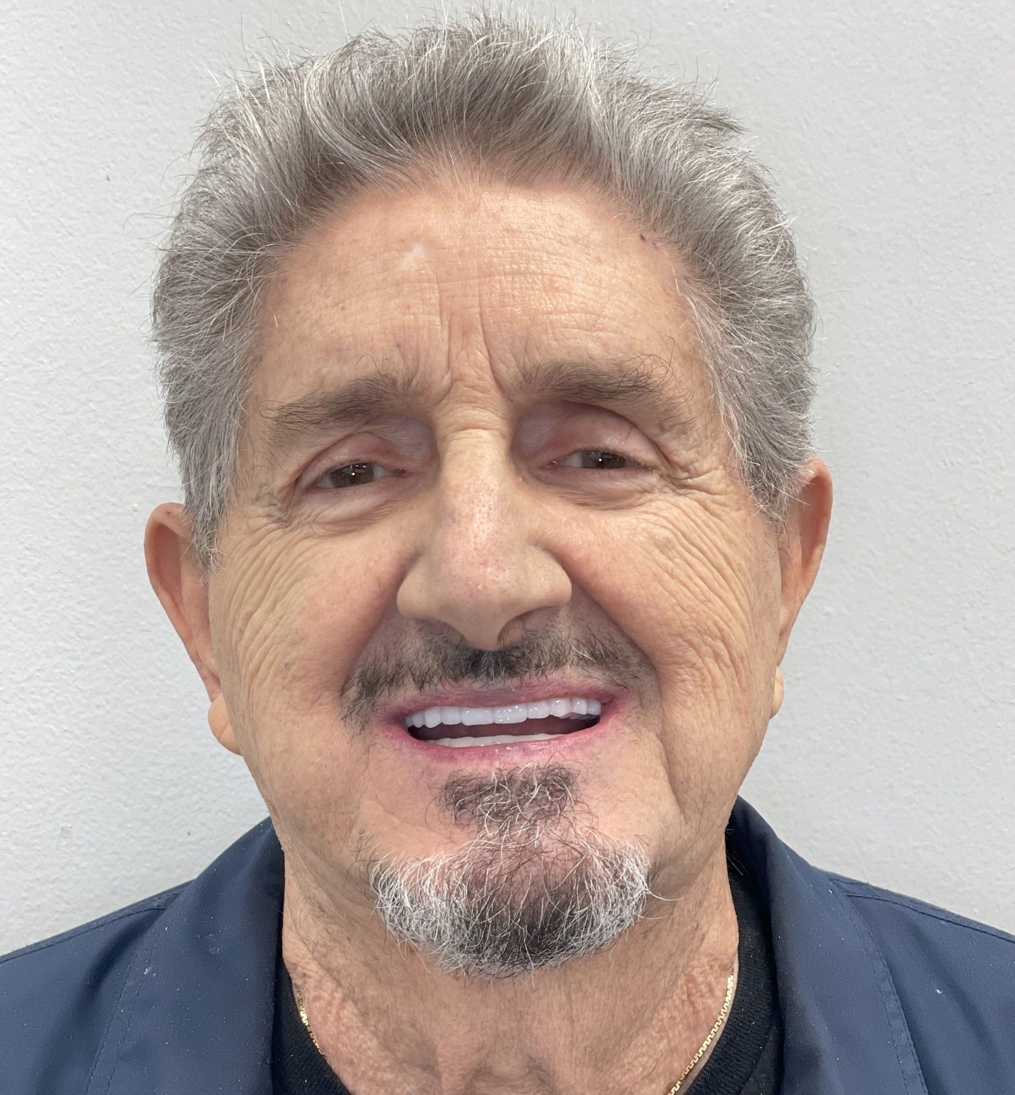after dental implants