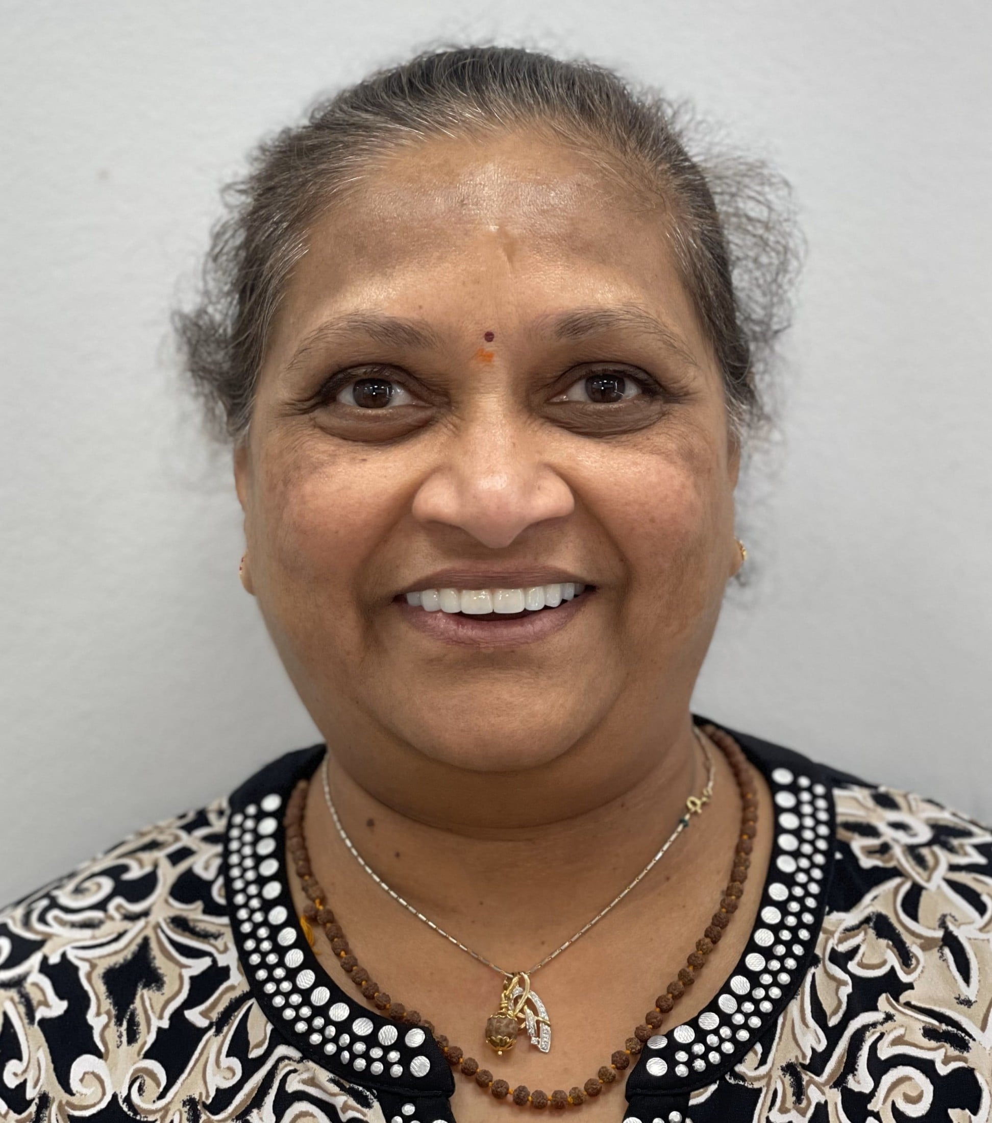 after dental implants