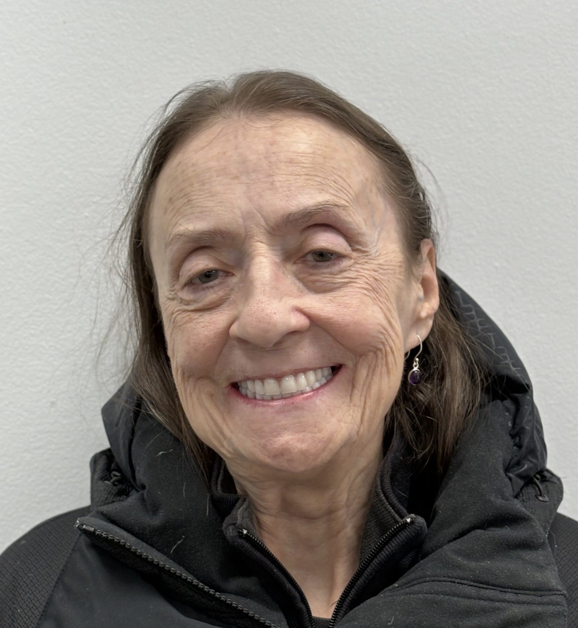 after dental implants